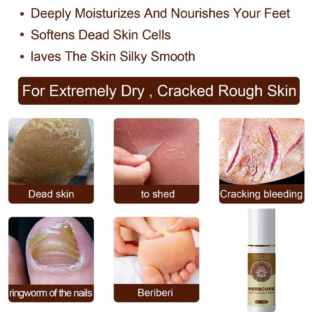 premiumantifungaltreatmentspray5.png