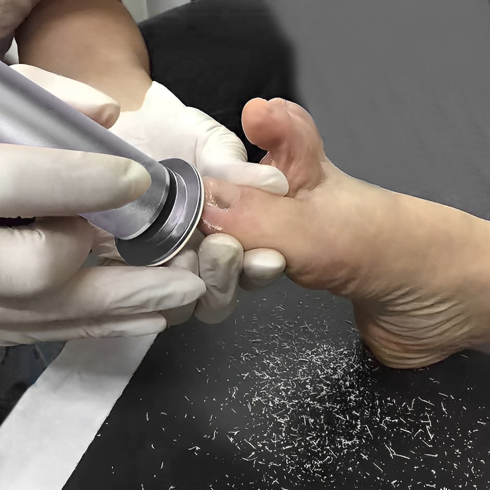 Electric callus remover with adjustable speed settings