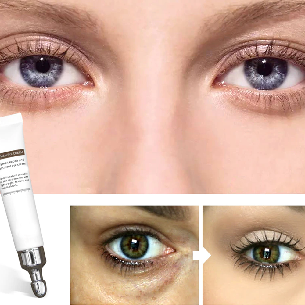 Effective eye treatment cream for digital screen users