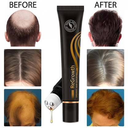 Scalp massage serum for increased hair volume