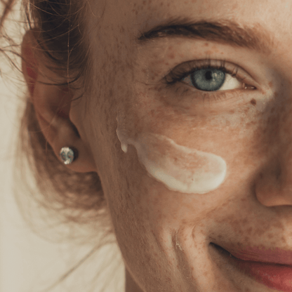 Eye Milia Removal Cream – Ideal Skincare Gift