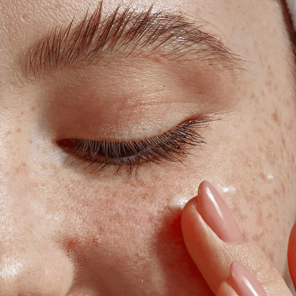 Eye Milia Removal Cream for Smooth Under Eyes