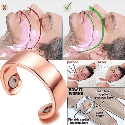 magneticacupressureantisnorering6.png