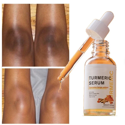 Turmeric serum for hyperpigmentation and uneven skin tone