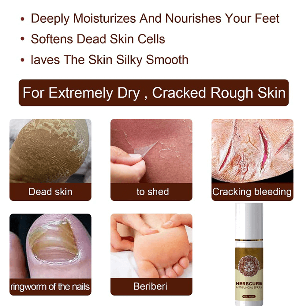 antifungaltreatmentspray3.png