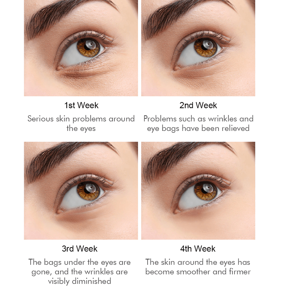 antiwrinklesmagicaleyecream3.png