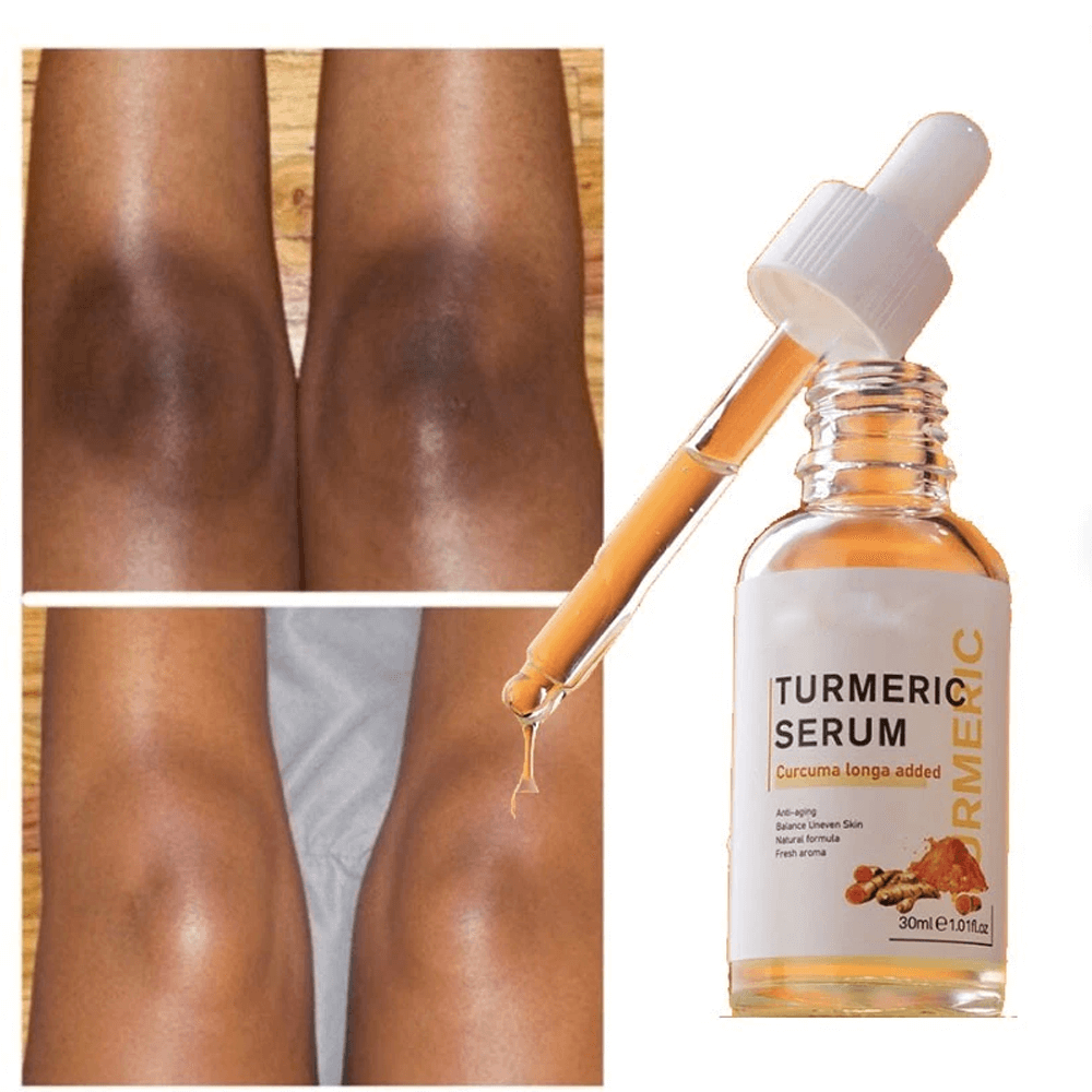 turmericdarkspotremoverserum5.png