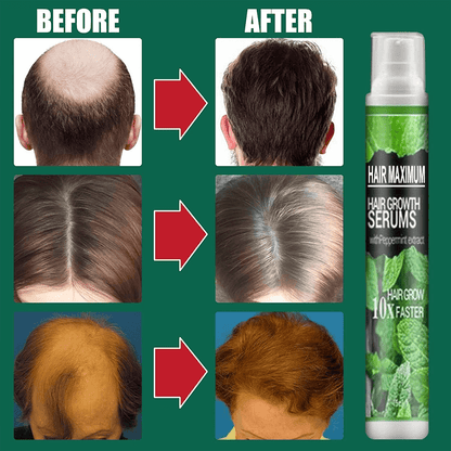 hairrebirthherbalspray3.png