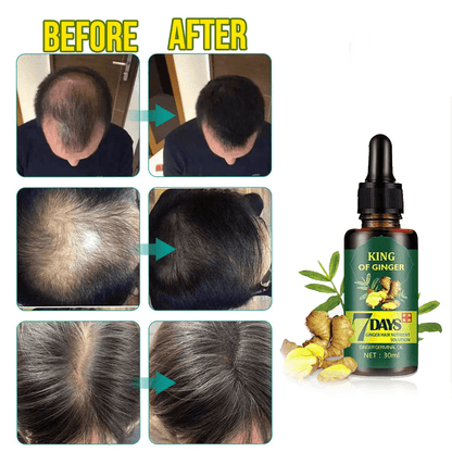 7dayherbgerminalserum3.png