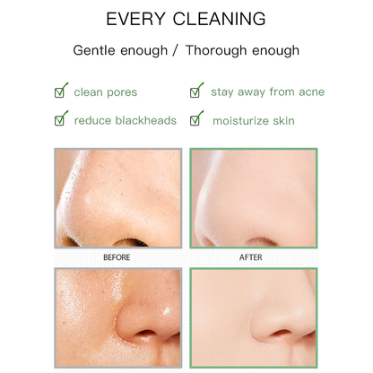skinpurifyingblackheadremovinggreenteamask3.png