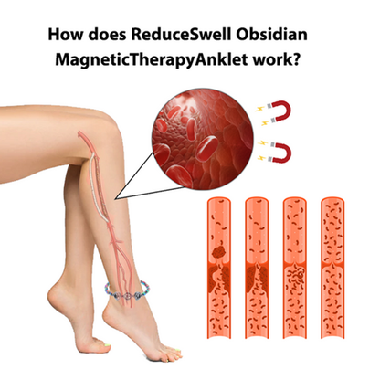 antiswellingmagneticanklet5.png