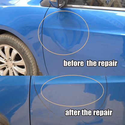 dentremovalwithtbar3.png