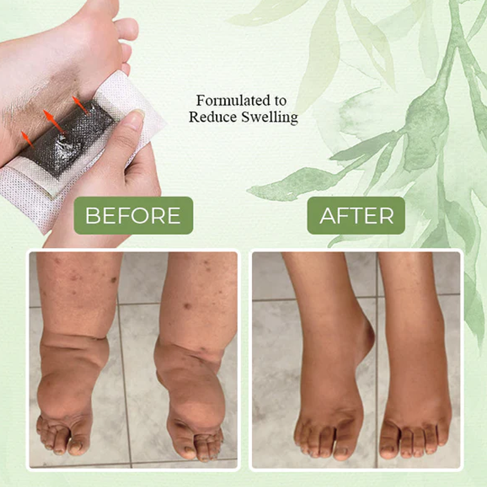 Herbal remedies for foot health and circulation