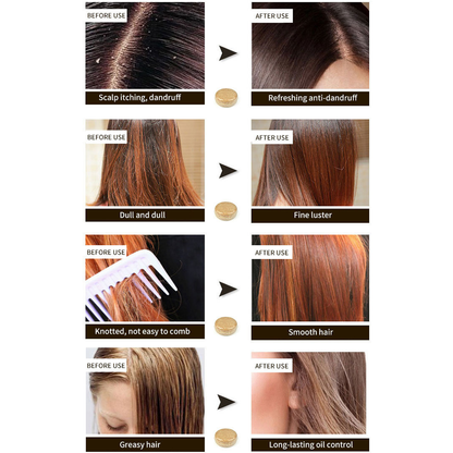 gingerhairregrowthshampoobar5.png