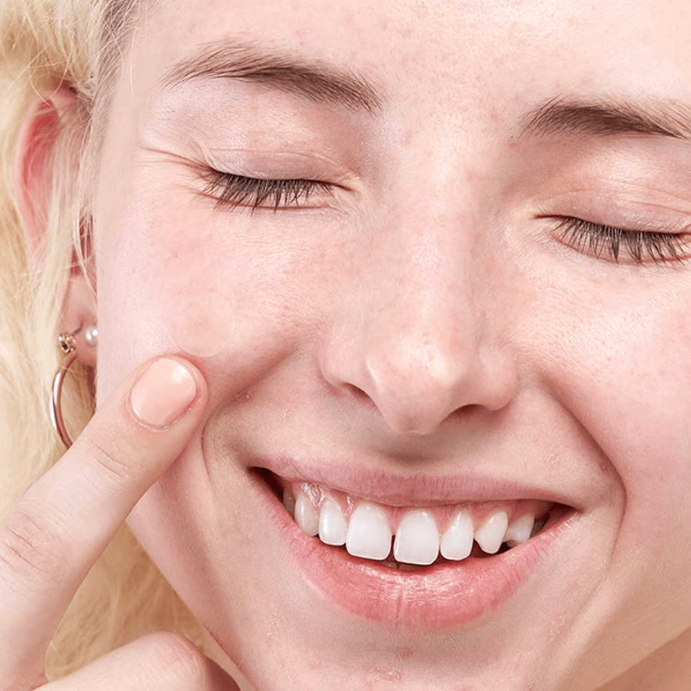 Noninvasive skin tag removal