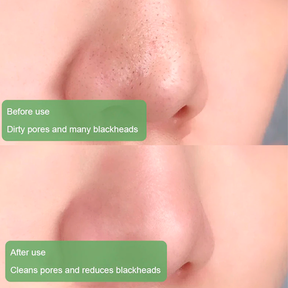 deepcleansingandblackheadremover6.png