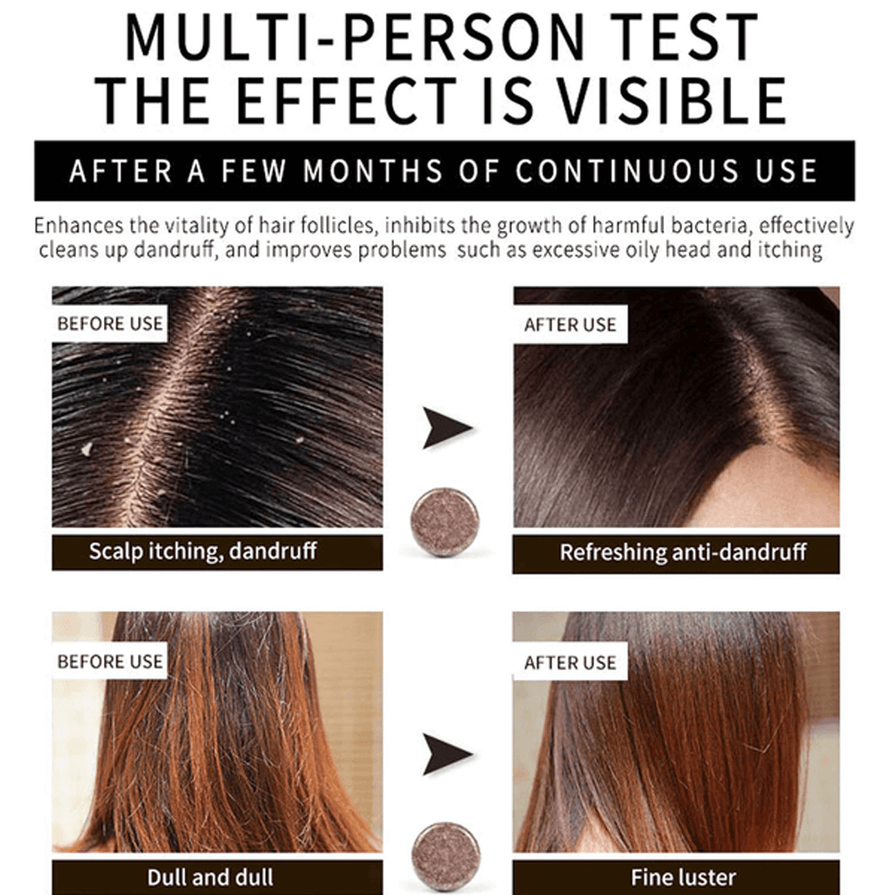 hairregrowthpolygonumhairdarkeningshampoobar5.png