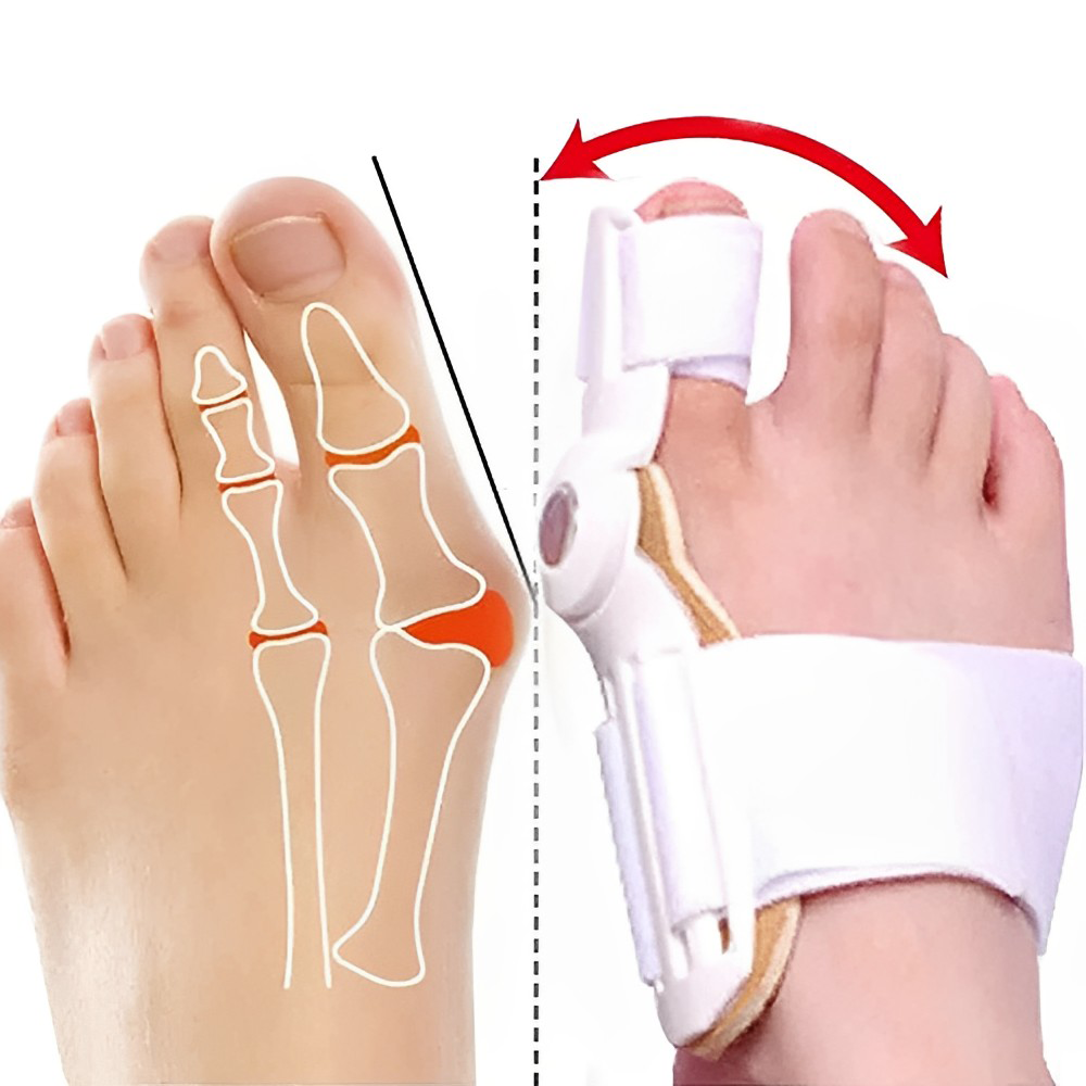 Orthopedic arch support for foot pain relief