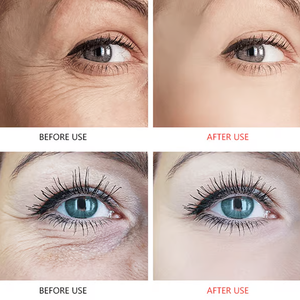 eyelinesmoisturizingeyepatches6.png