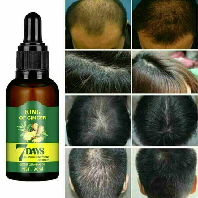 Hair Care Hair Growth Serum for Men  Women