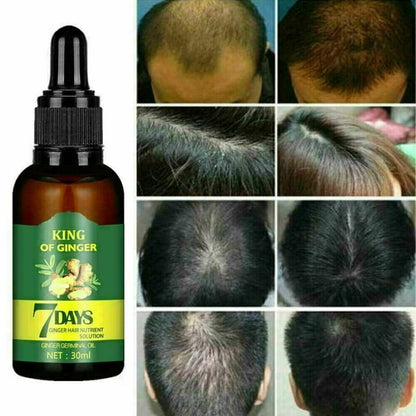 Hair Care Hair Growth Serum for Men  Women