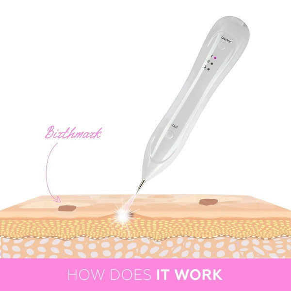 Revolutionary Skin Care - Plasma Pen Skin Tag & Mole Remover with Long-Lasting Battery, USB Rechargeable 4