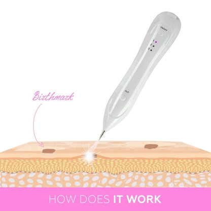 Revolutionary Skin Care - Plasma Pen Skin Tag & Mole Remover with Long-Lasting Battery, USB Rechargeable 4