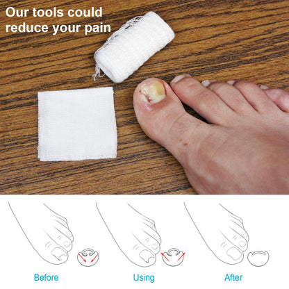 Ingrown Toe Nail Fixer Device (8).jpg