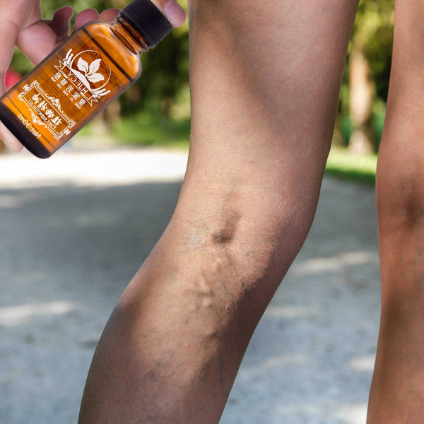 Lymphatic Drainage Ginger Essential Oil for Swelling, 30ml Natural Formula in Premium Glass Bottle 1