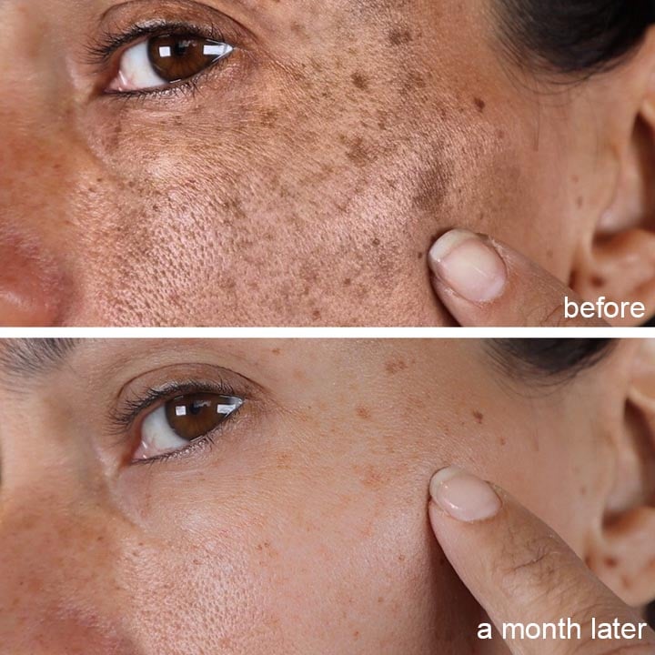 Melanin Correcting Essential Oil 3