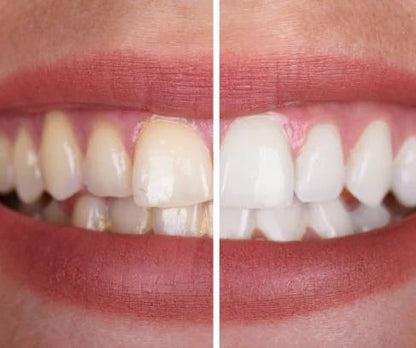 Teeth Colour Corrector Serum 4