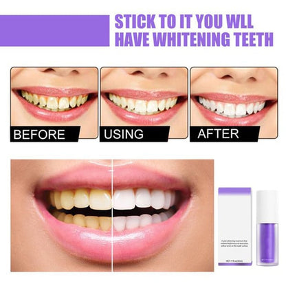 Teeth Colour Corrector Serum 2