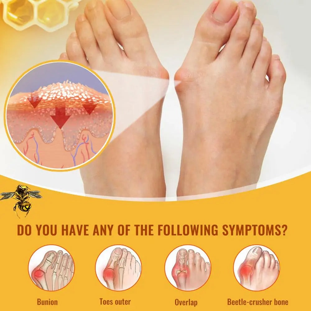 Bee Venom Treatment Gel 4