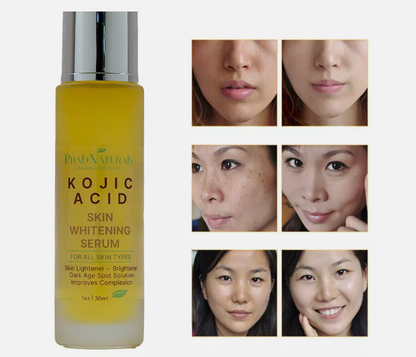 Kojic Acid Skin Whitening Lightening Brightening Serum Bleaching Spot Fade Cream