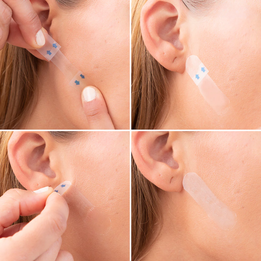 Face Lifting Tape Strips For A Beautifully Slim Face 5