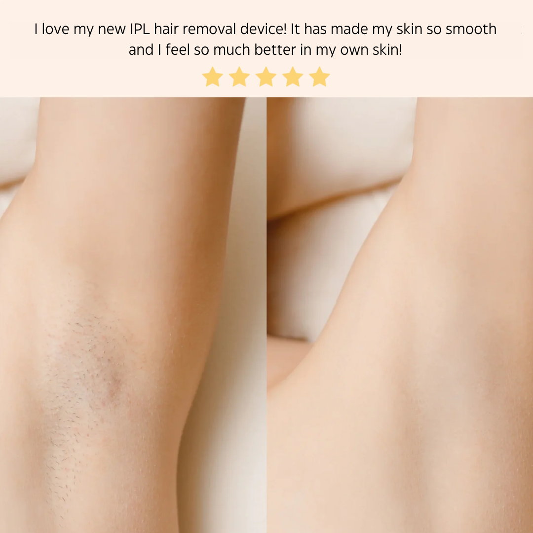 IPL Laser Hair Removal Handset System  Painless And Safe For All Skin Types Perfect For Home Use 5