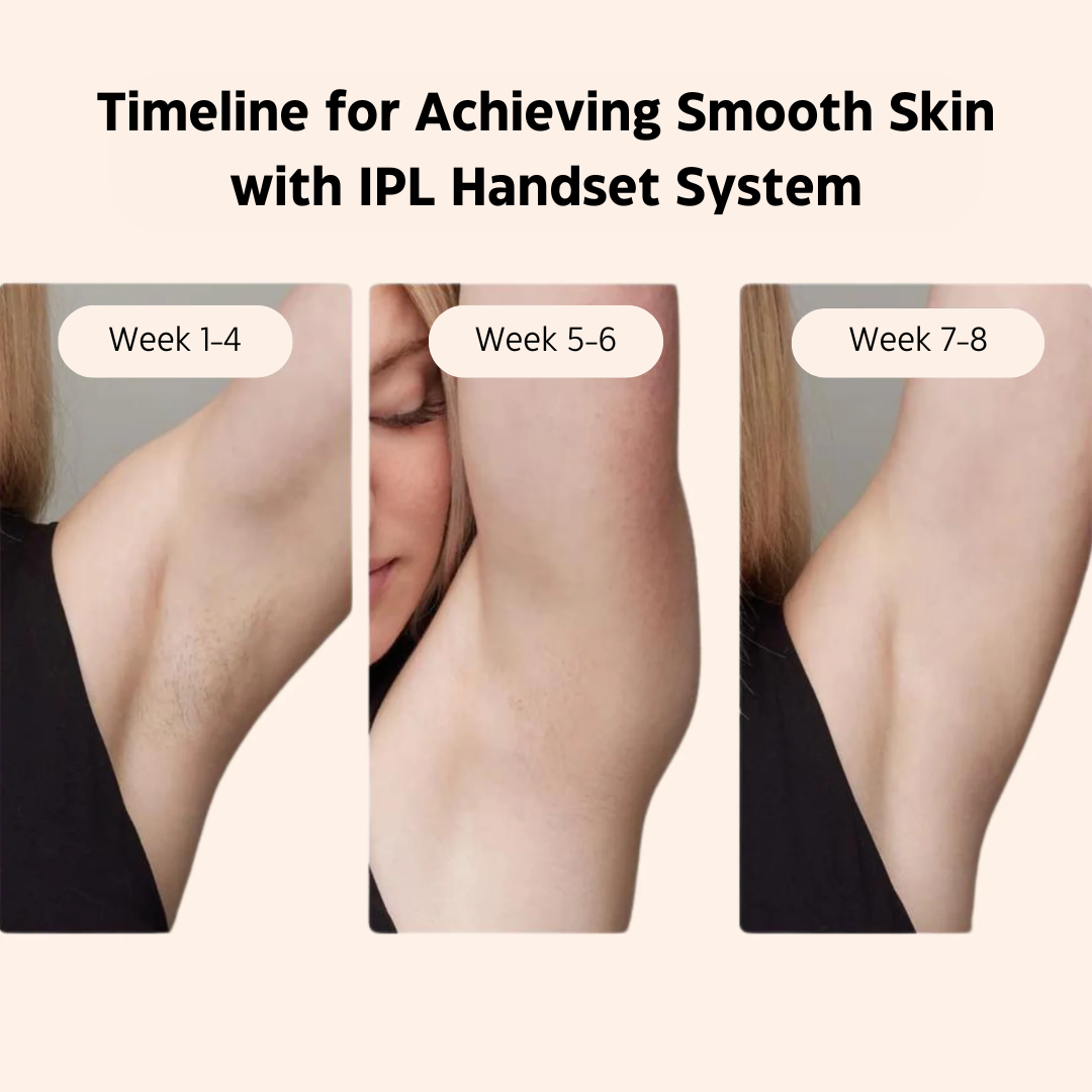 IPL Laser Hair Removal Handset System 4