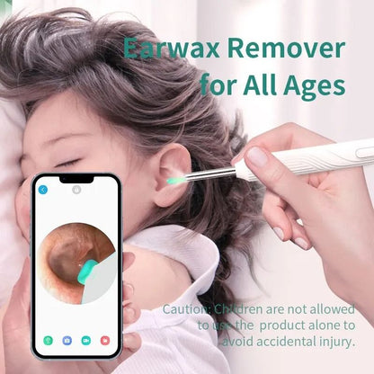 HD Wireless Ear Cleaner With Camera  Smart Otoscope Earwax Removal Tool Kit With 6 LED Lights 4