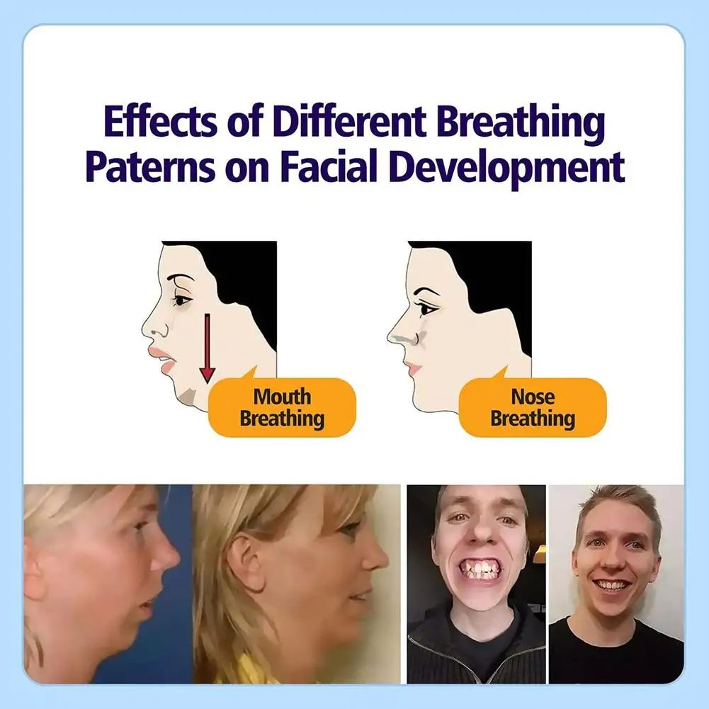 Anti Snoring Mouth Patch For Adults  Children Sleep Breathing Orthosis Tape To Stop Snoring  Improv