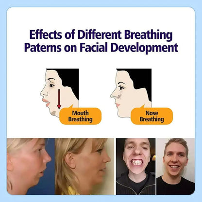 Anti Snoring Mouth Patch For Adults  Children Sleep Breathing Orthosis Tape To Stop Snoring  Improv
