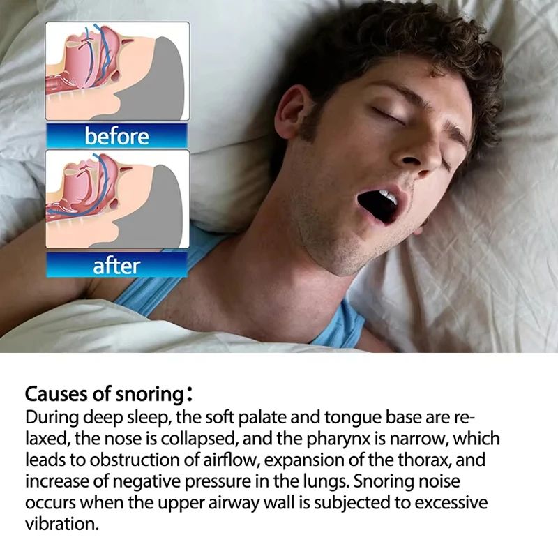 Mouth Tape For Sleep Apnea  Snoring Breathing Mouth Tape For Better Sleep 2