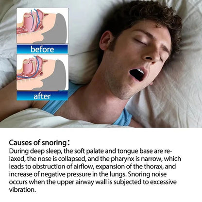 Mouth Tape For Sleep Apnea  Snoring Breathing Mouth Tape For Better Sleep 2
