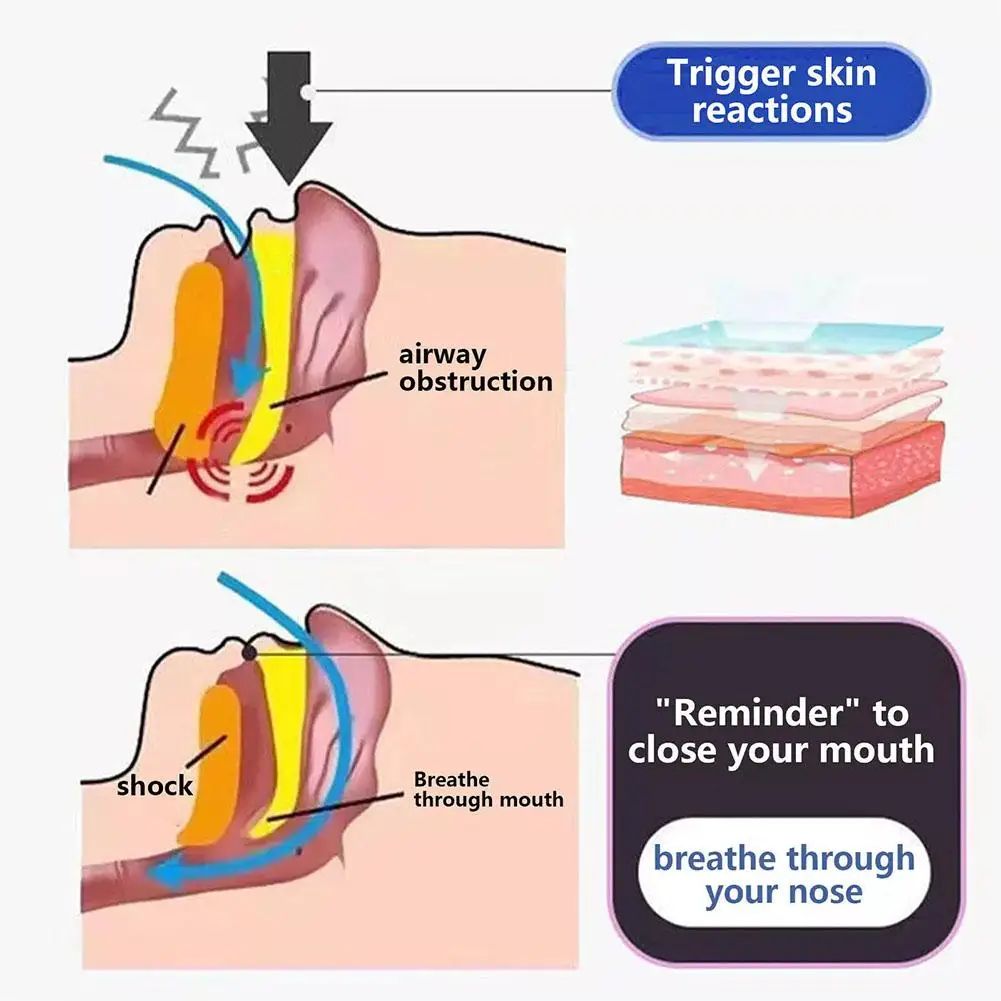 Anti Snoring Sticker For Better Sleep Improve Mouth Breathing With Nighttime Sleep Mouth Correction