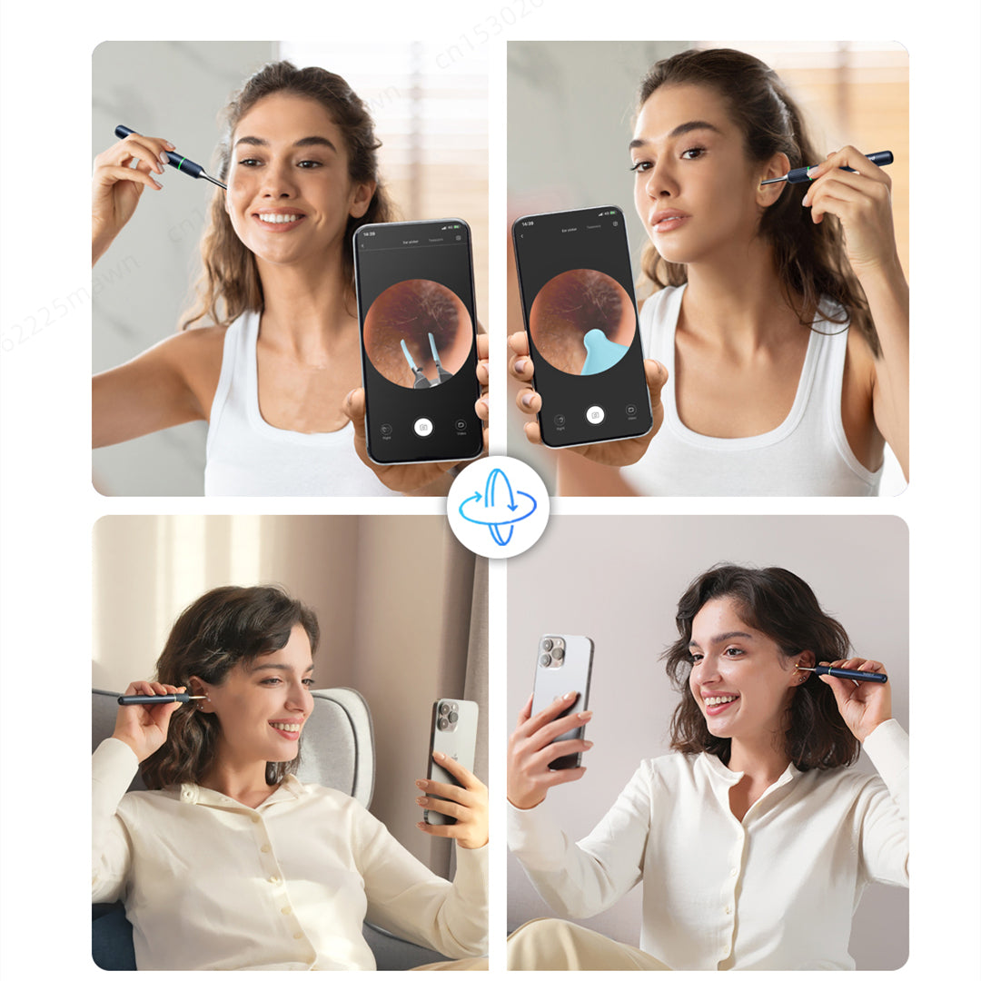 Smart Otoscope Ear Cleaner, Visual Endoscope Tweezers with Mini Camera for Precision Ear Health Care