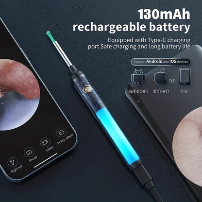 Professional Ear Wax Removal Kit  1296P HD Endoscope With USBC Charging  AtHome Ear Cleaning  Healt 2