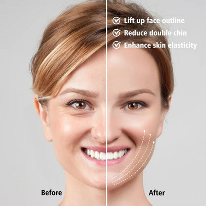 EMS Face Lifting Massager AntiWrinkle VFace Device For Double Chin Removal  Skin Firming 1