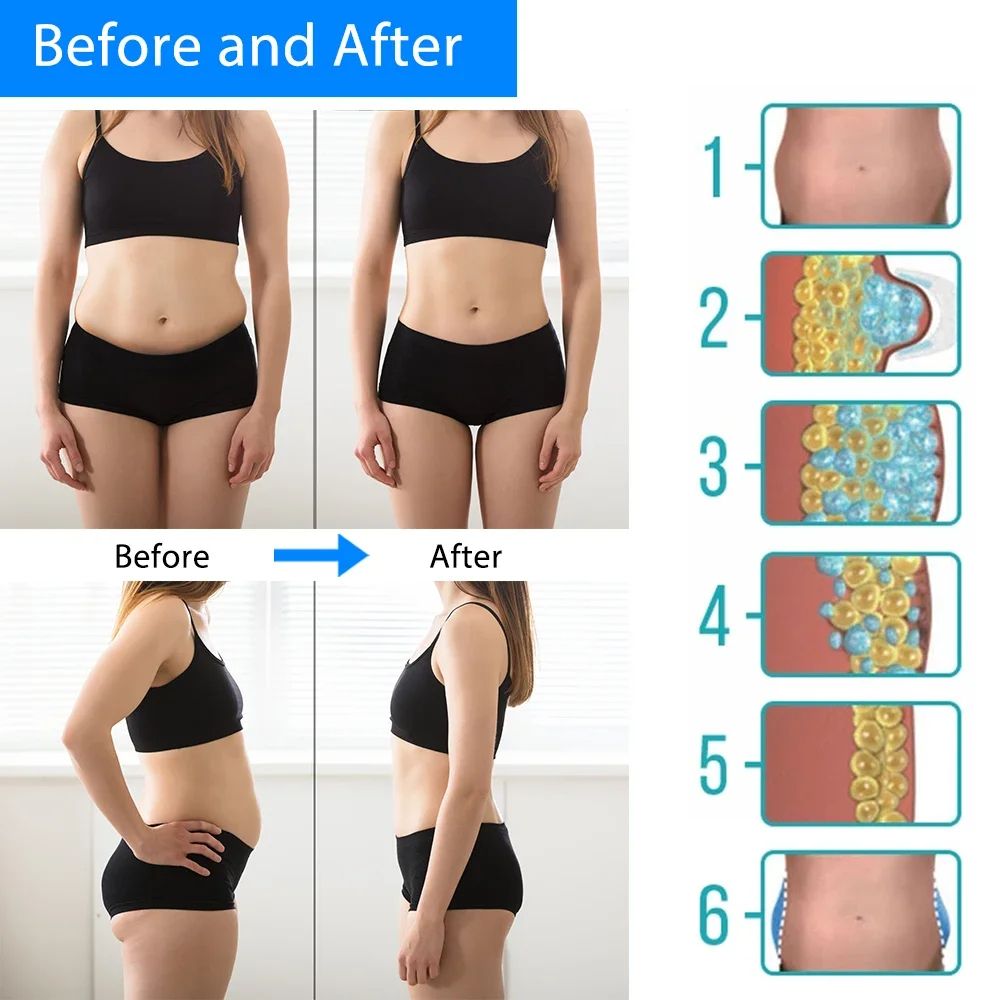 Cryotherapy Dissolve Fat Lipo Freezing Machine Cold Therapy Anti Cellulite Abdominal Massager For F 5