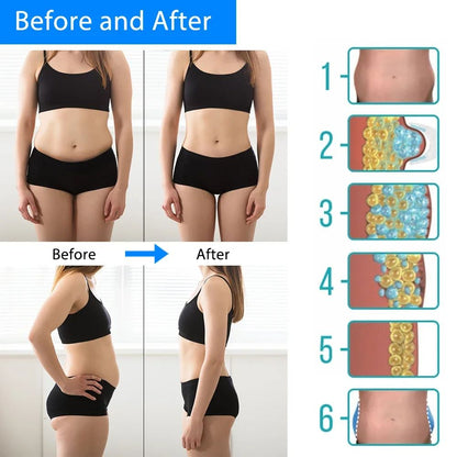 Cryotherapy Dissolve Fat Lipo Freezing Machine Cold Therapy Anti Cellulite Abdominal Massager For F 5