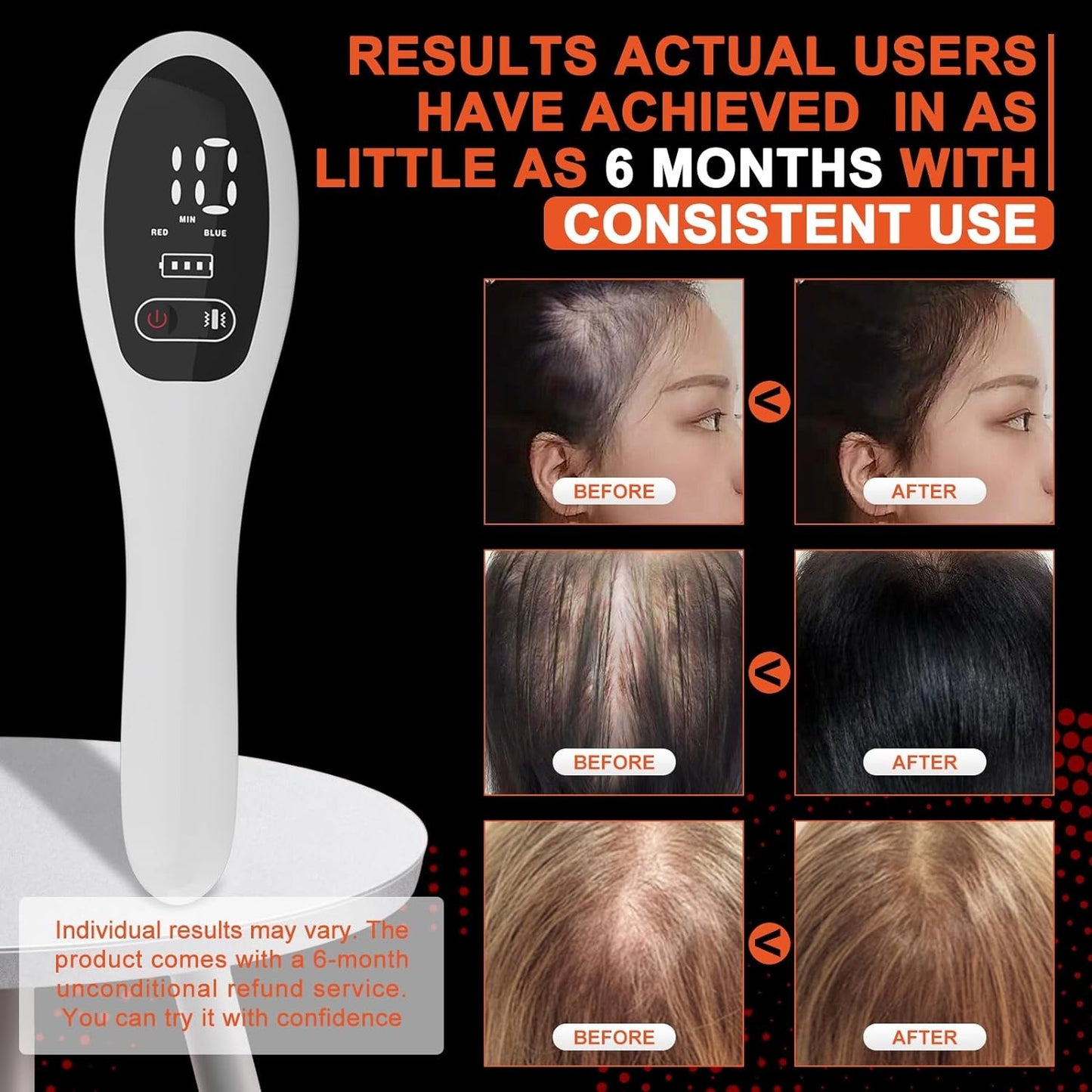 Electric Laser Hair Growth Comb Anti Hair Loss Therapy with Infrared  LED Red Light for Thicker Ha