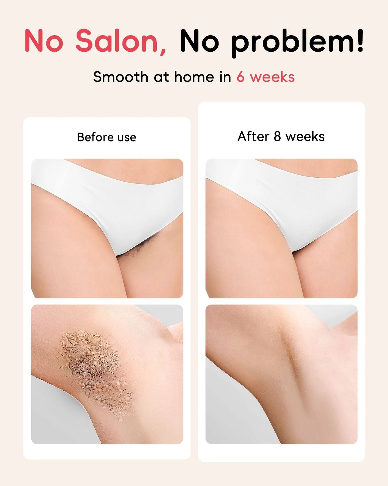 Hair Removal Laser With Unlimited IGBT  Fast Flashes Painless Body Epilator For Bikini Armpit  Face 2